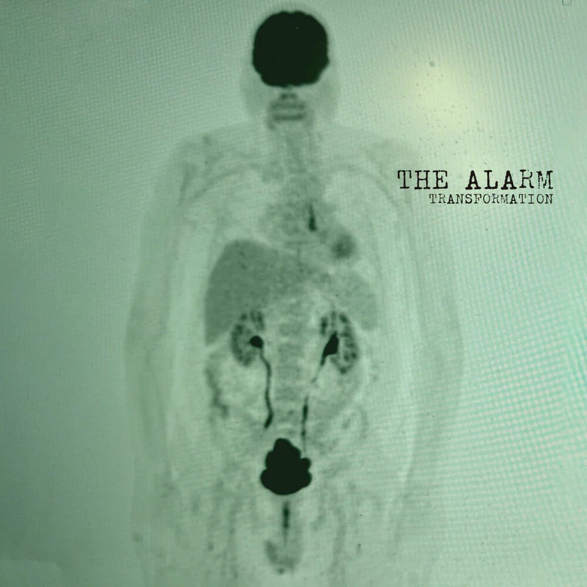 Alarm - Transformation [Colored Vinyl] (Grn) (Can)